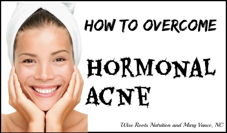 How to Overcome Hormonal Acne